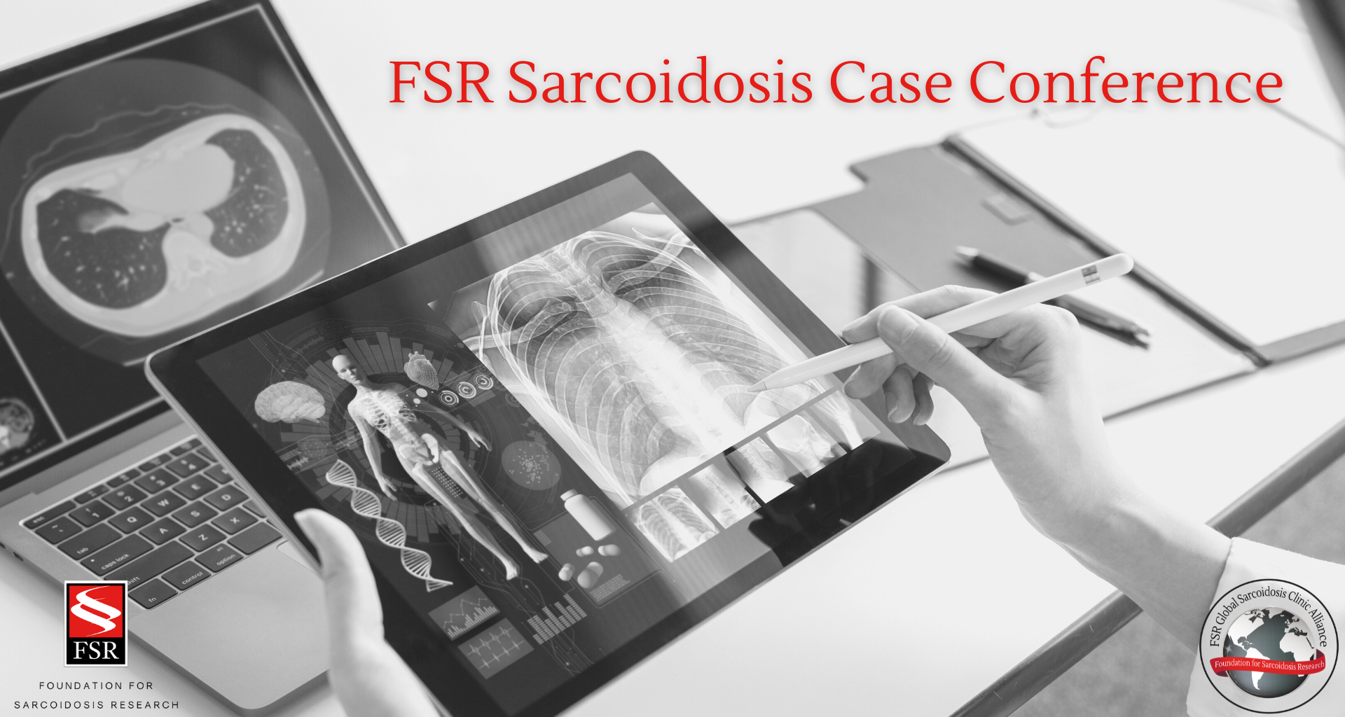 Peer Case Image with Date
