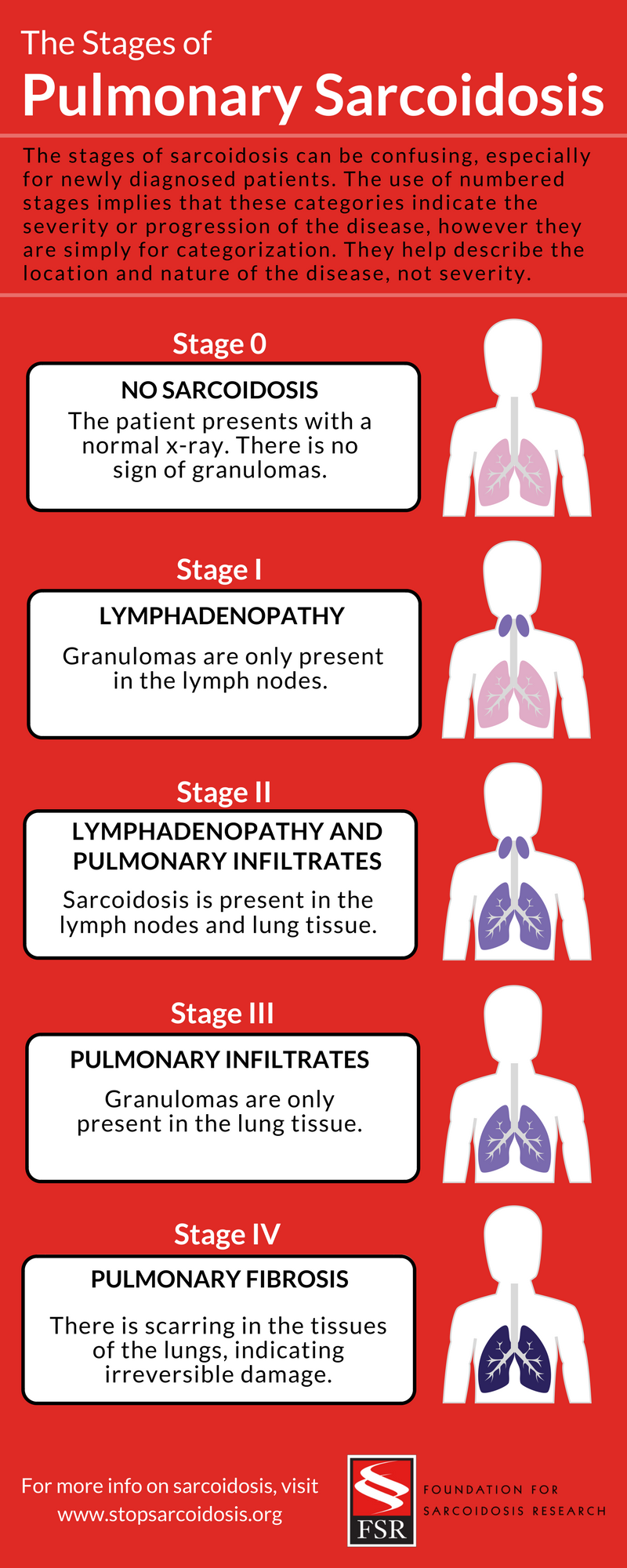 The Stages Of Pulmonary Sarcoidosis What Do They Really Mean Foundation For Sarcoidosis Research