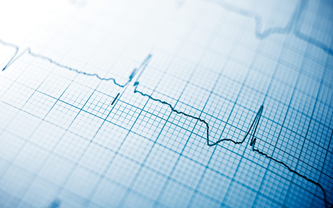 Understanding Cardiac Sarcoidosis