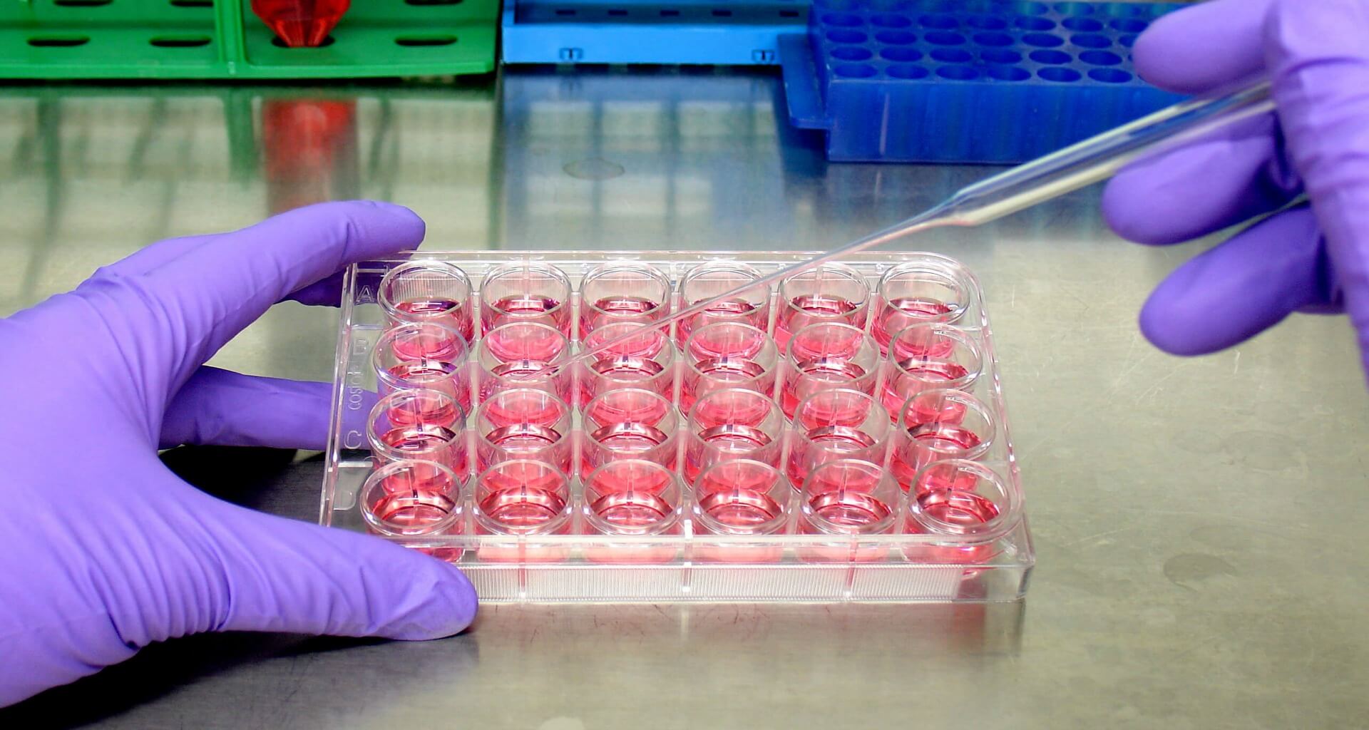 tray of samples in lab